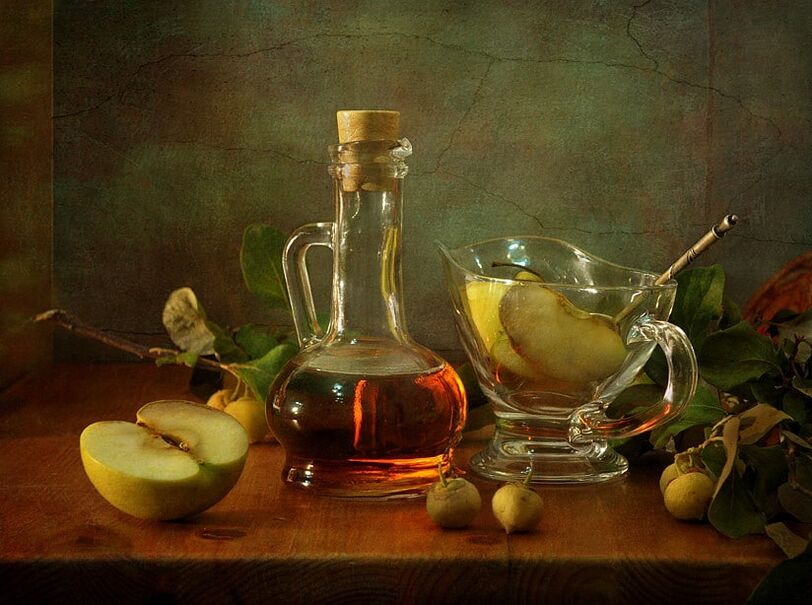 天然苹果醋将帮助您消除腿部静脉曲张。